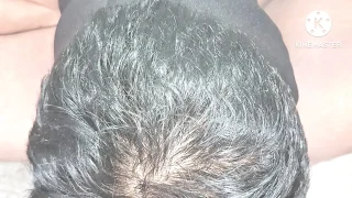 Boyfriend Removed His Girlfriend Hairy Pussy To A Clean Pussy